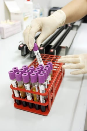 Knowing Your Biological Age via an Innovative Blood Test