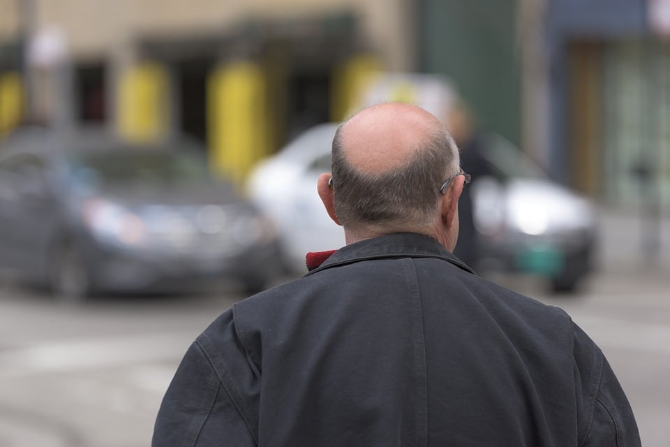 Hair Loss Myths Are These 5 Common Hair Beliefs True Or False All